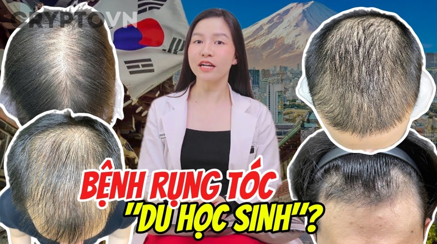 Người mới nên chọn ví cứng như thế nào để phù hợp nhu cầu lưu trữ crypto?