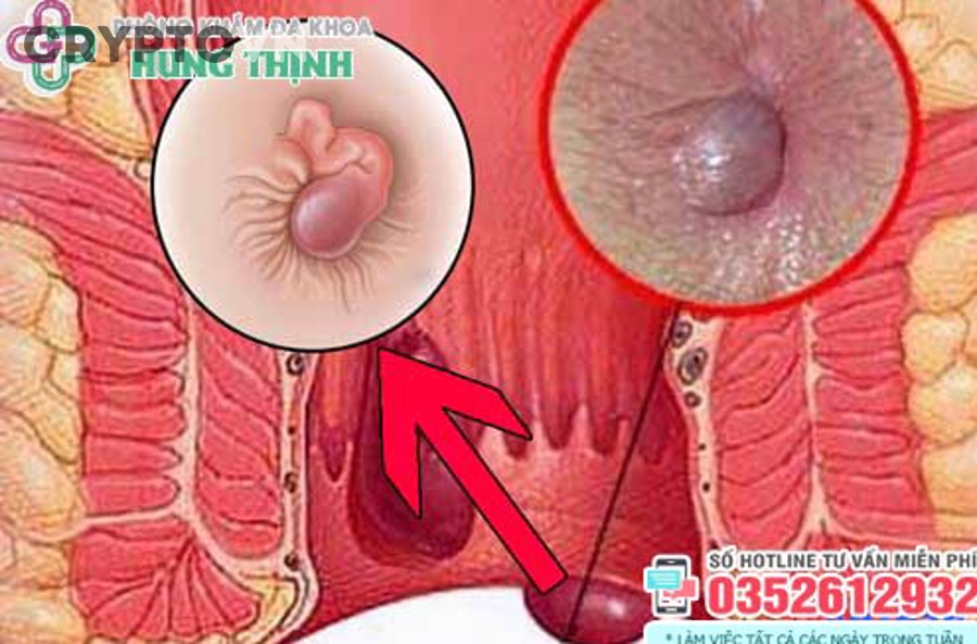 Cách Giảm Phí Giao Dịch Crypto: 7 Mẹo Tối Ưu Chi Phí Cho Người Mới